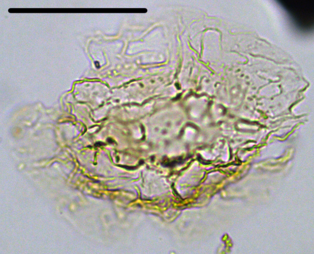 Heteraulacacysta pramparoae Het27X31101120901065b.jpg